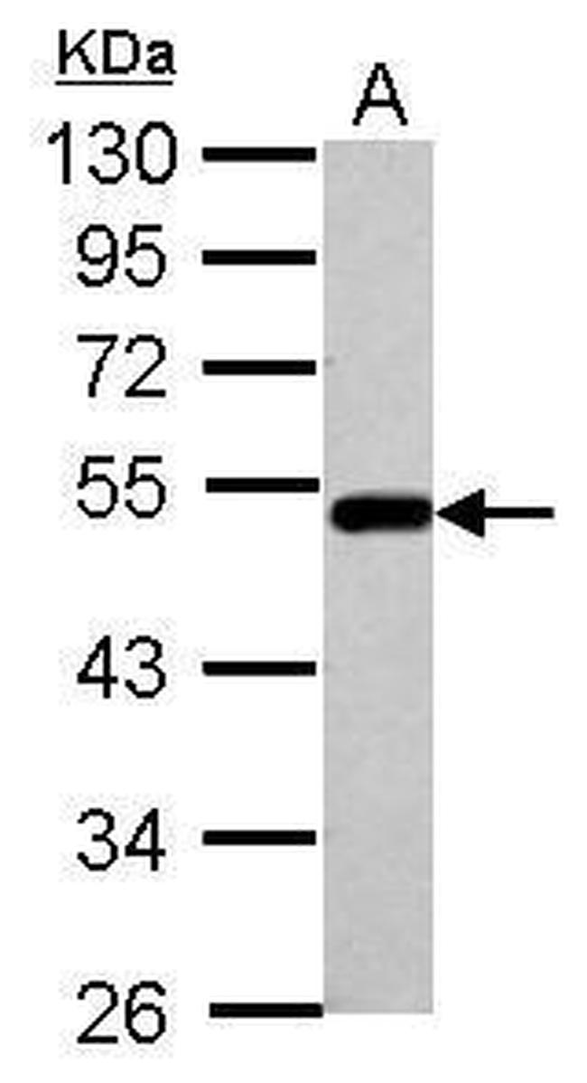 BLMH Antibody in Western Blot (WB)