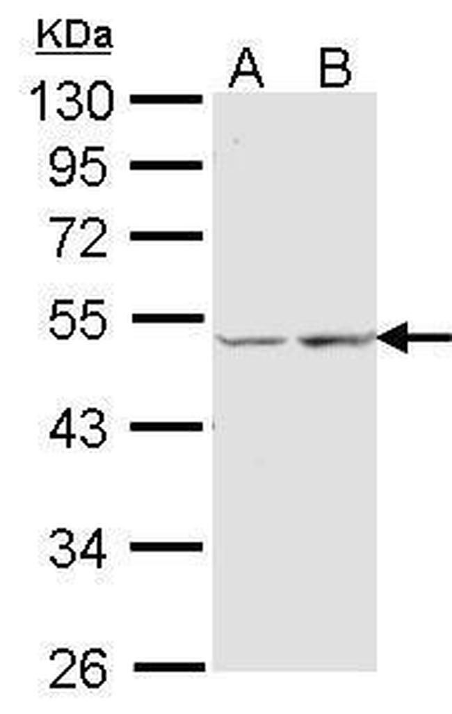 COX15 Antibody in Western Blot (WB)