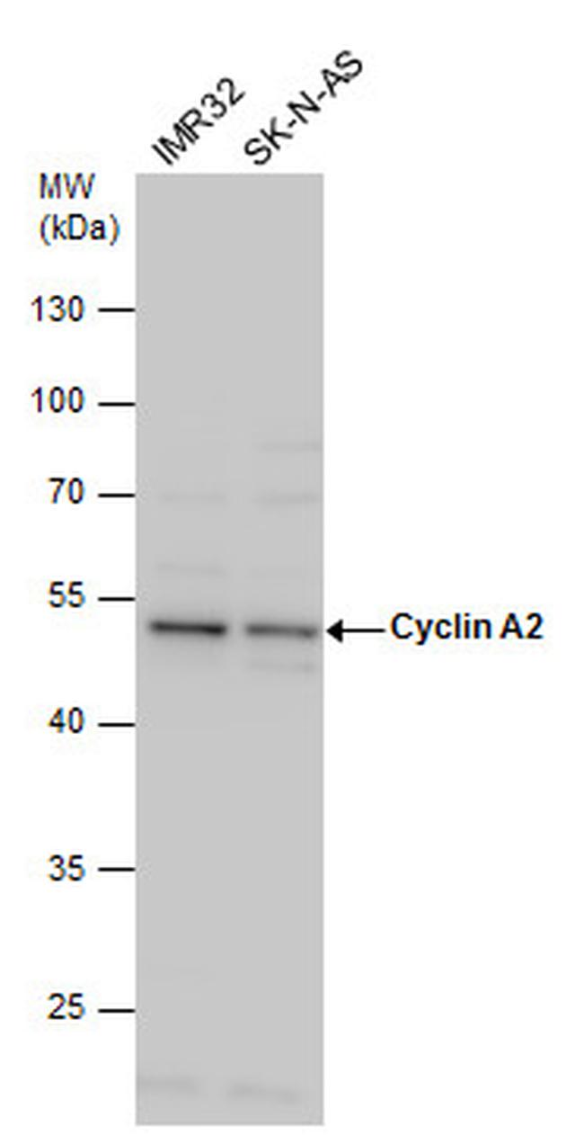 Cyclin A2 Antibody in Western Blot (WB)