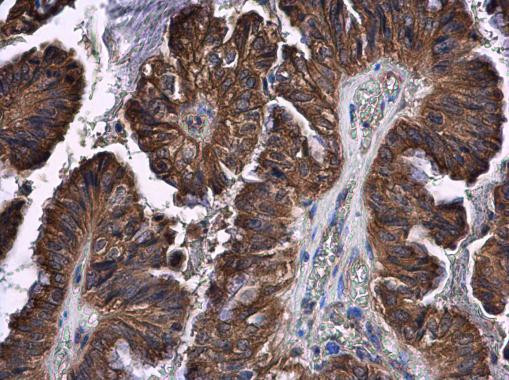 STAT2 Antibody in Immunohistochemistry (Paraffin) (IHC (P))