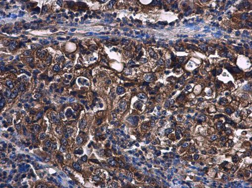 STAT2 Antibody in Immunohistochemistry (Paraffin) (IHC (P))