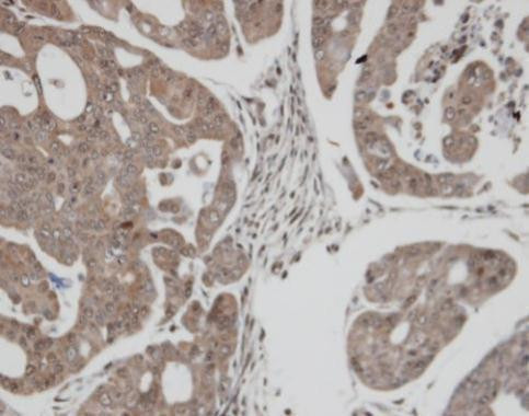 TrxR1 Antibody in Immunohistochemistry (Paraffin) (IHC (P))