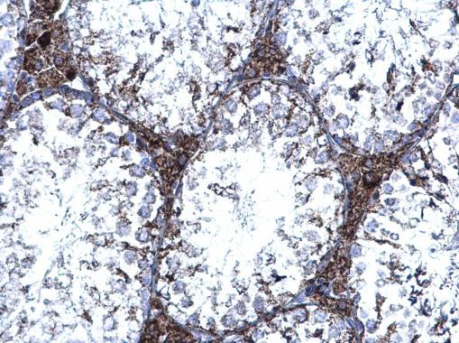 TrxR1 Antibody in Immunohistochemistry (Paraffin) (IHC (P))