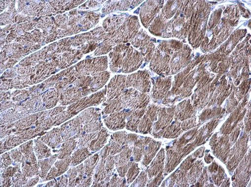 TrxR1 Antibody in Immunohistochemistry (Paraffin) (IHC (P))