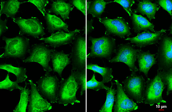 BIN1 Antibody in Immunocytochemistry (ICC/IF)