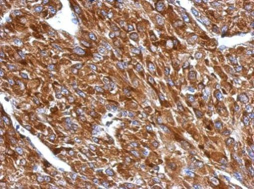 BIN1 Antibody in Immunohistochemistry (Paraffin) (IHC (P))