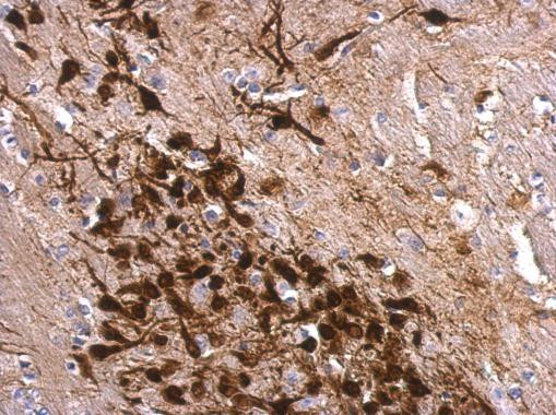 Calretinin Antibody in Immunohistochemistry (Paraffin) (IHC (P))