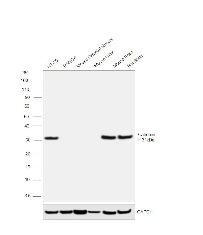 Calretinin Antibody in Western Blot (WB)