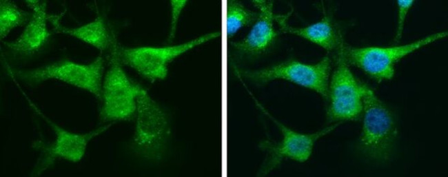 Calretinin Antibody in Immunocytochemistry (ICC/IF)