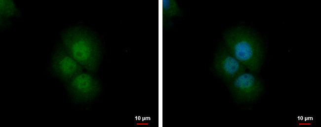 PRMT2 Antibody in Immunocytochemistry (ICC/IF)