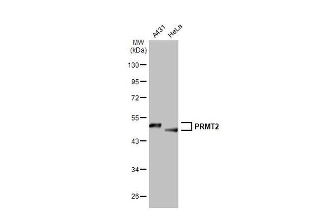 PRMT2 Antibody in Western Blot (WB)