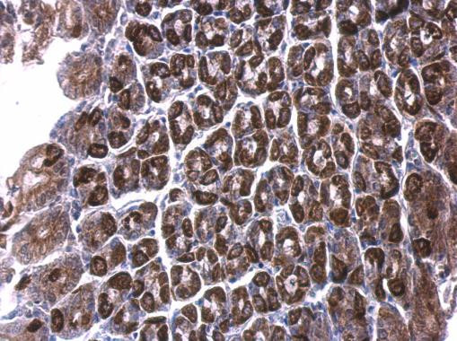 ALDH6A1 Antibody in Immunohistochemistry (Paraffin) (IHC (P))