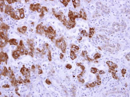 ALDH6A1 Antibody in Immunohistochemistry (Paraffin) (IHC (P))