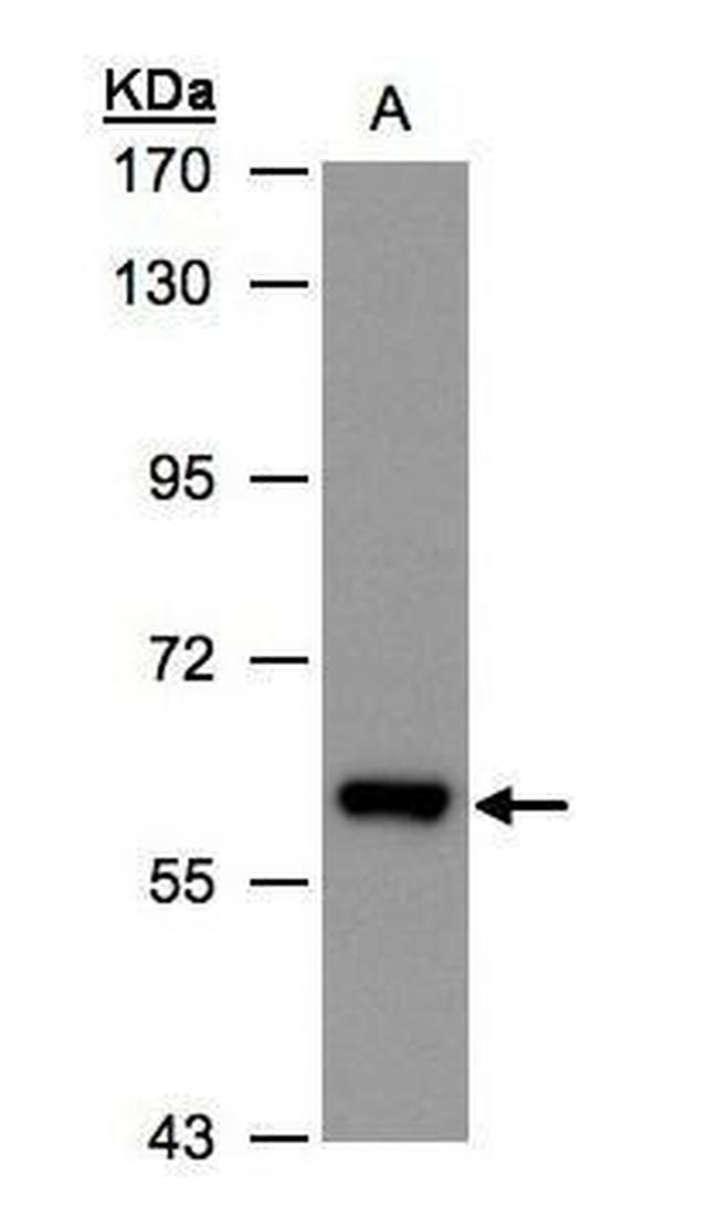 ALDH6A1 Antibody in Western Blot (WB)