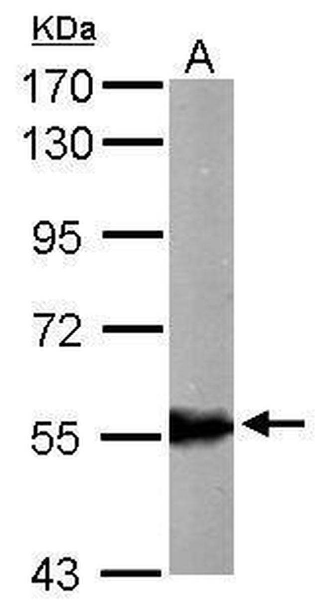 ALDH6A1 Antibody in Western Blot (WB)