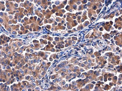 Calpastatin Antibody in Immunohistochemistry (Paraffin) (IHC (P))