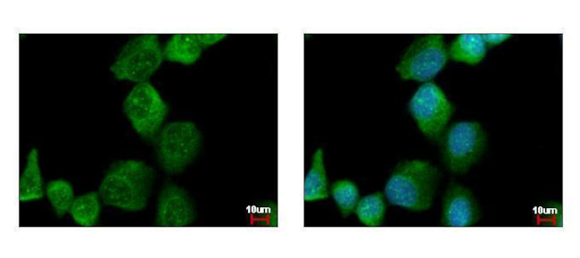 PAK1 Antibody in Immunocytochemistry (ICC/IF)