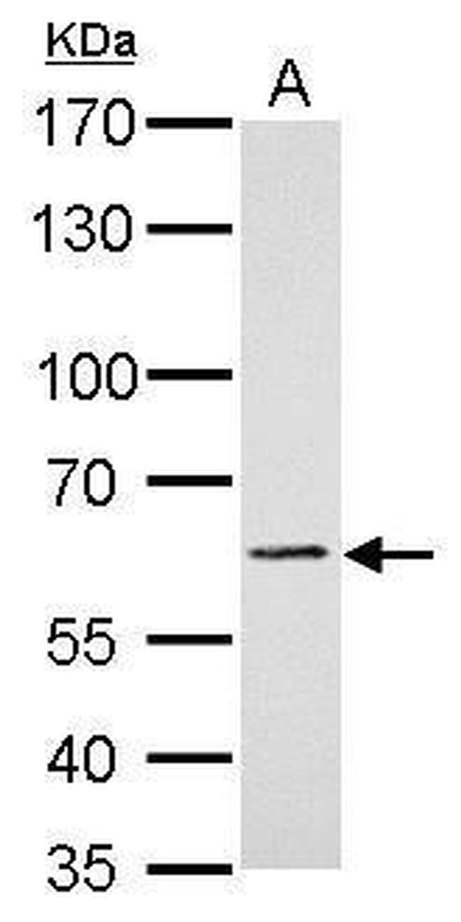 PAK1 Antibody in Western Blot (WB)