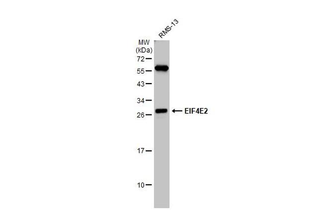 eIF4E2 Antibody in Western Blot (WB)