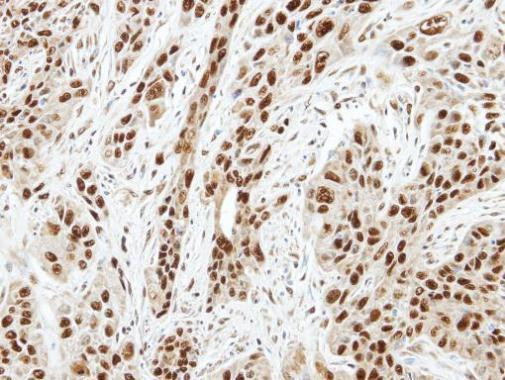 Aurora A Antibody in Immunohistochemistry (Paraffin) (IHC (P))