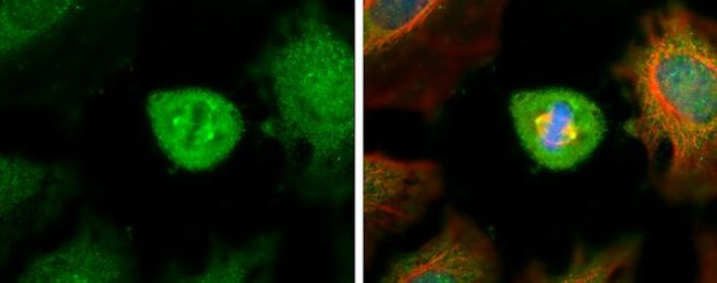 Aurora A Antibody in Immunocytochemistry (ICC/IF)