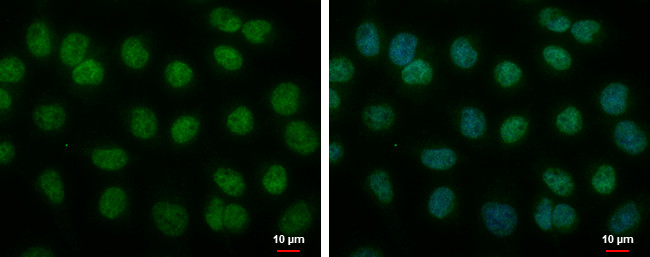 BMAL1 Antibody in Immunocytochemistry (ICC/IF)