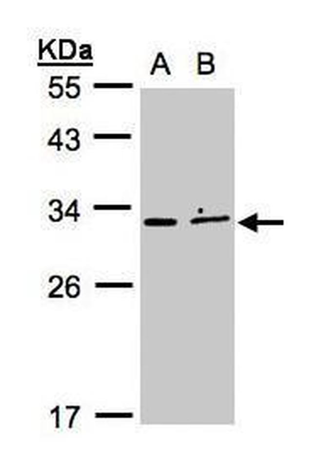 XRCC2 Antibody in Western Blot (WB)