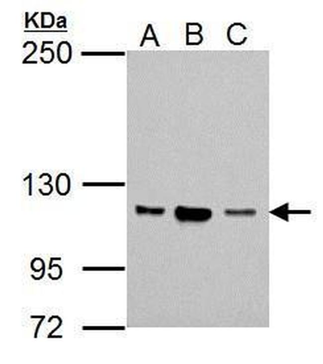 NOP2 Antibody in Western Blot (WB)