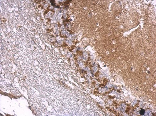 Drebrin Antibody in Immunohistochemistry (Paraffin) (IHC (P))