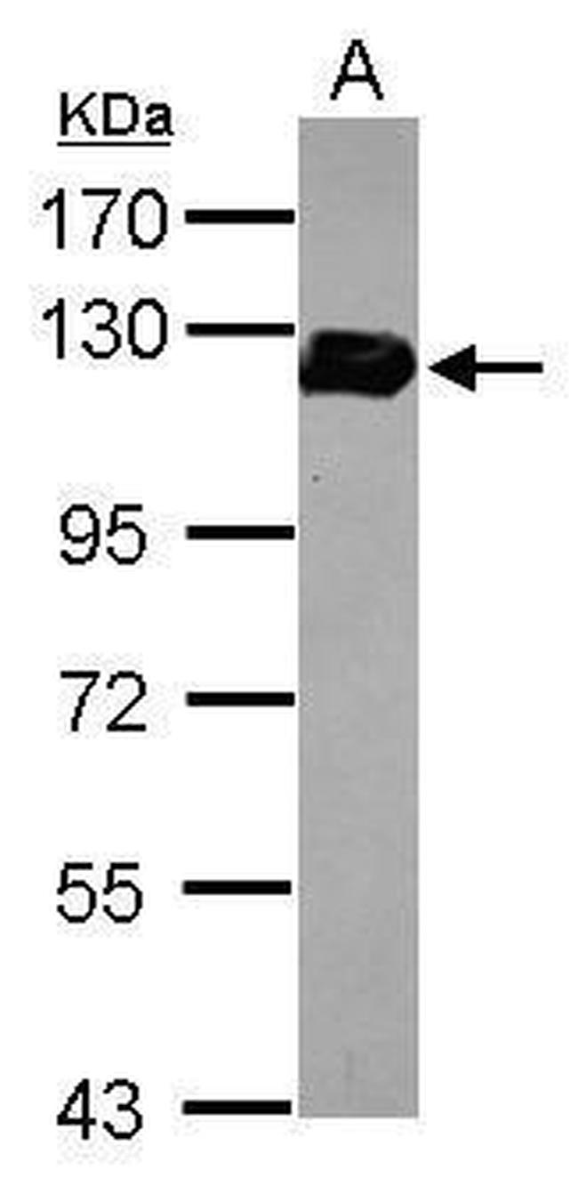 Drebrin Antibody in Western Blot (WB)