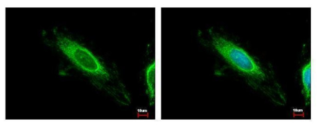 TBRG4 Antibody in Immunocytochemistry (ICC/IF)