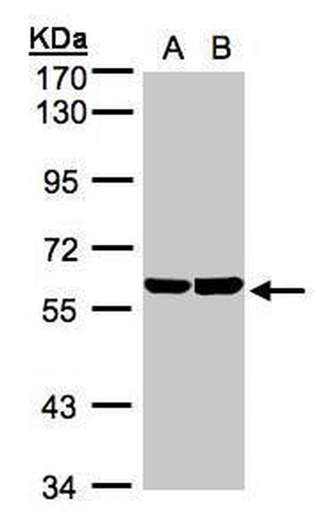 TBRG4 Antibody in Western Blot (WB)