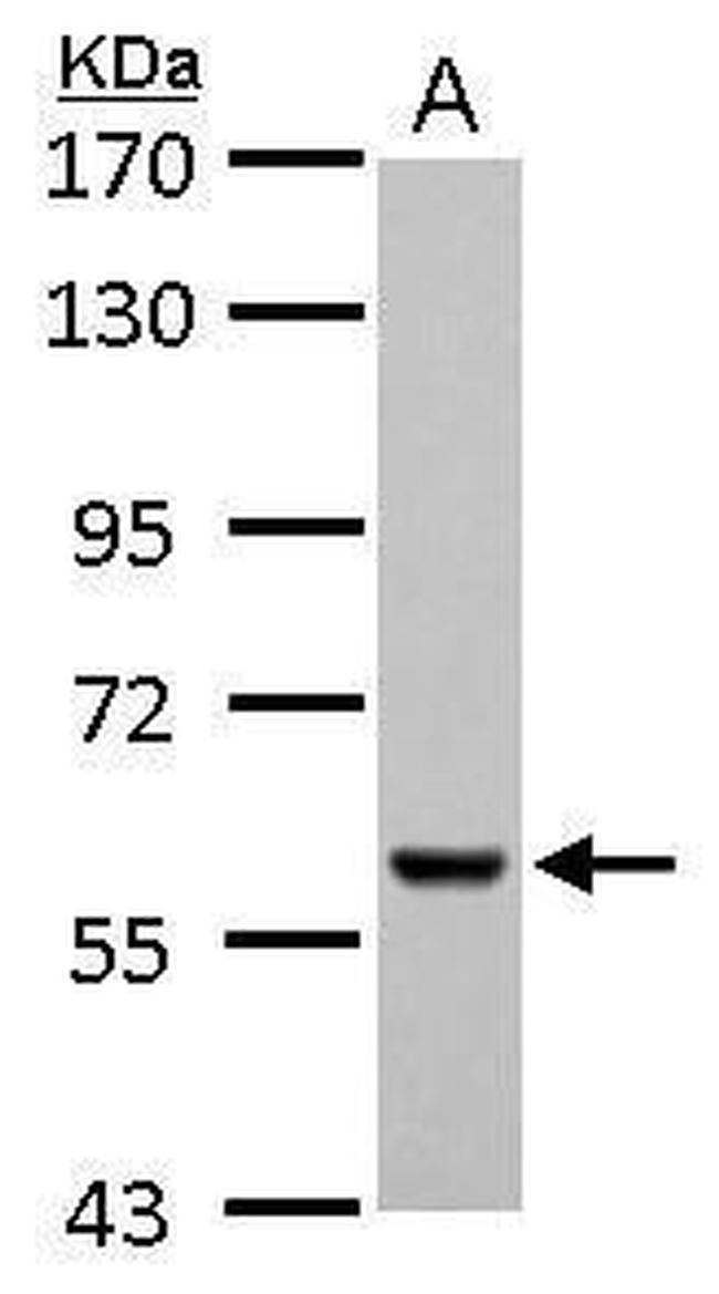 PKLR Antibody in Western Blot (WB)