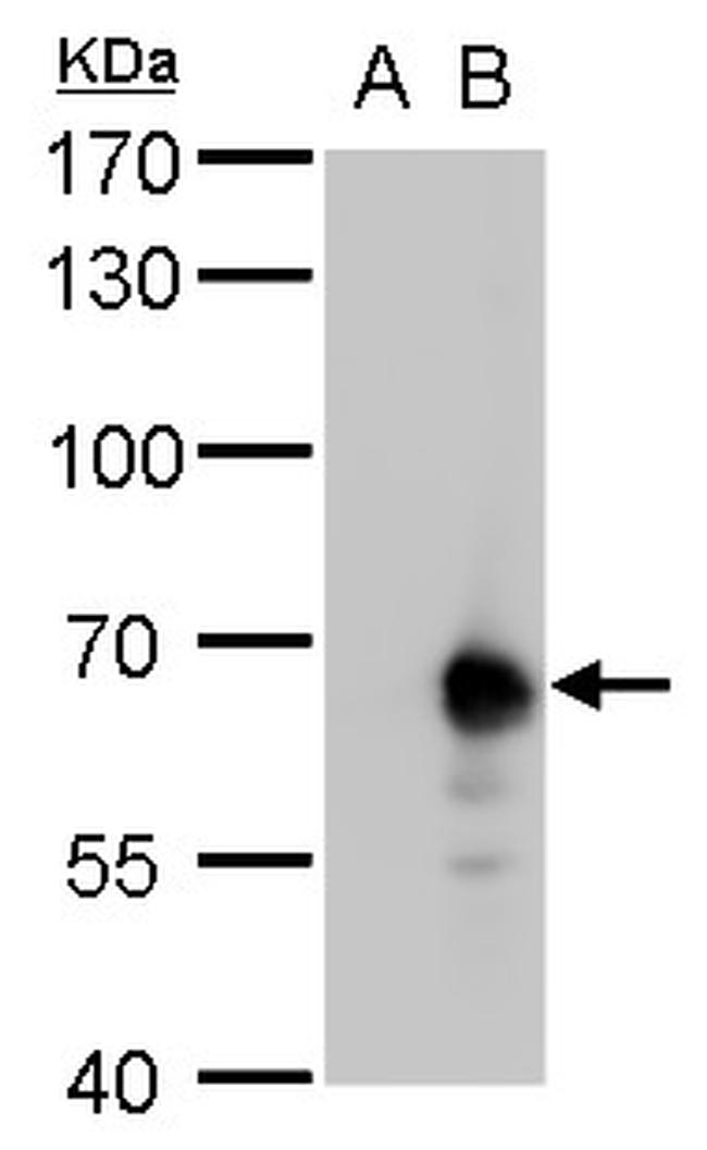 PKLR Antibody in Western Blot (WB)