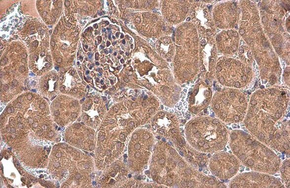 NFkB p65 Antibody in Immunohistochemistry (Paraffin) (IHC (P))