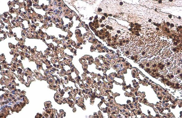 NFkB p65 Antibody in Immunohistochemistry (Paraffin) (IHC (P))