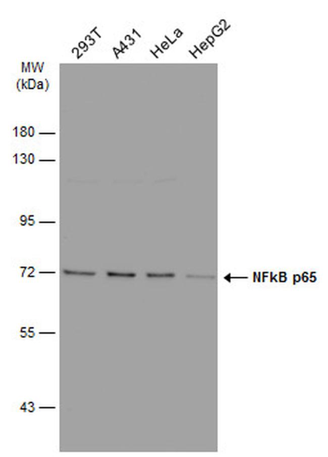 NFkB p65 Antibody in Western Blot (WB)