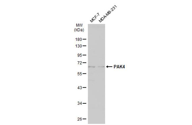 PAK4 Antibody in Western Blot (WB)