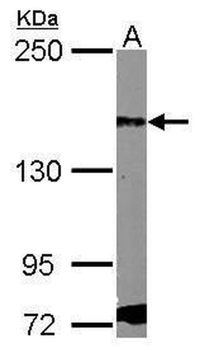 PDGFRA Antibody in Western Blot (WB)