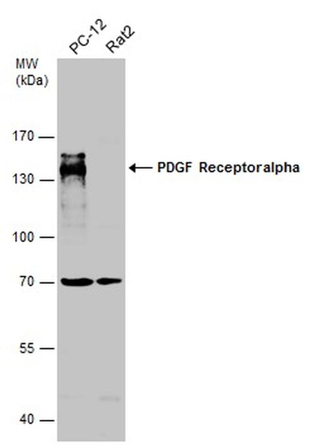 PDGFRA Antibody in Western Blot (WB)