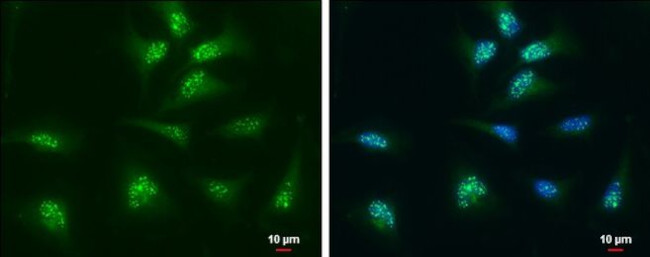 Thioredoxin 1 Antibody in Immunocytochemistry (ICC/IF)