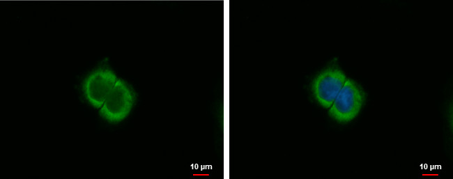 CXCL9 Antibody in Immunocytochemistry (ICC/IF)