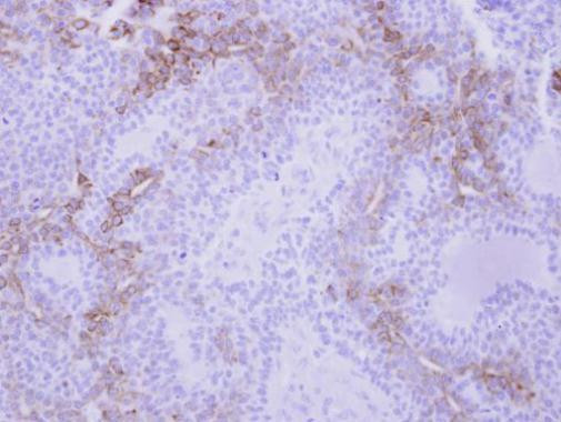 CXCL9 Antibody in Immunohistochemistry (Paraffin) (IHC (P))