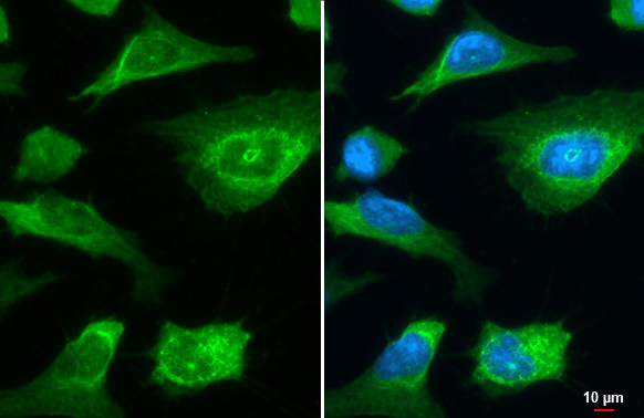 LIMCH1 Antibody in Immunocytochemistry (ICC/IF)