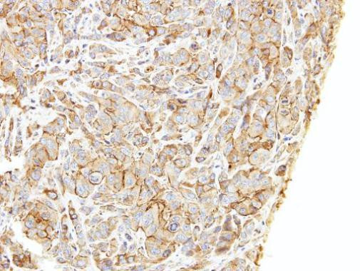 LIMCH1 Antibody in Immunohistochemistry (Paraffin) (IHC (P))