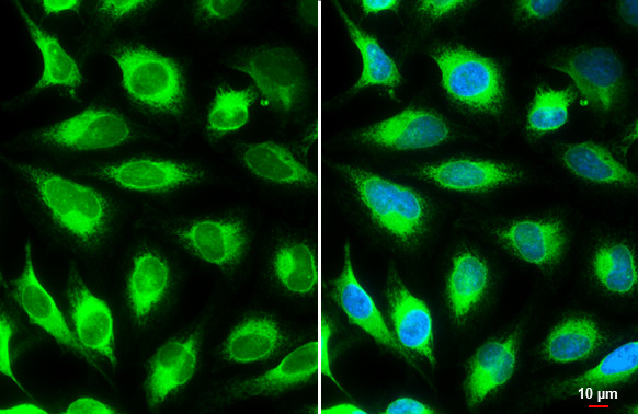 Calnexin Antibody in Immunocytochemistry (ICC/IF)