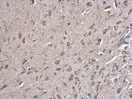 Calnexin Antibody in Immunohistochemistry (Paraffin) (IHC (P))