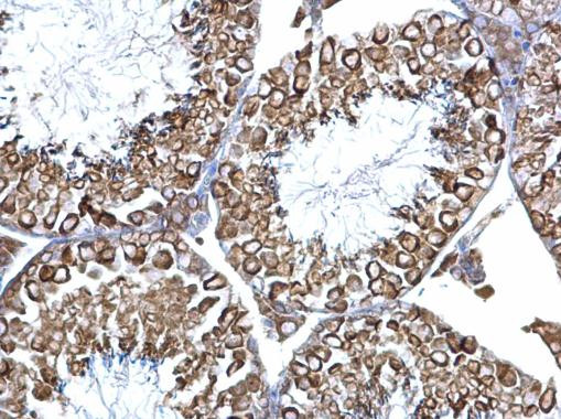 Calnexin Antibody in Immunohistochemistry (Paraffin) (IHC (P))