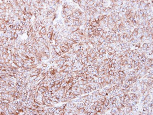 Calnexin Antibody in Immunohistochemistry (Paraffin) (IHC (P))