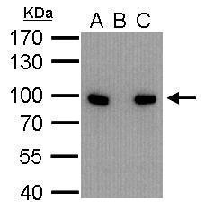 Calnexin Antibody in Immunoprecipitation (IP)